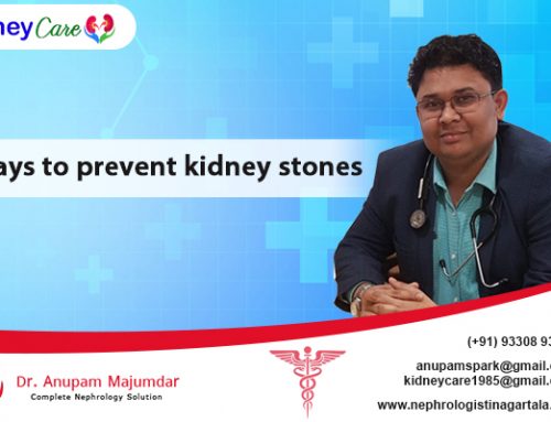 5 ways to prevent kidney stones